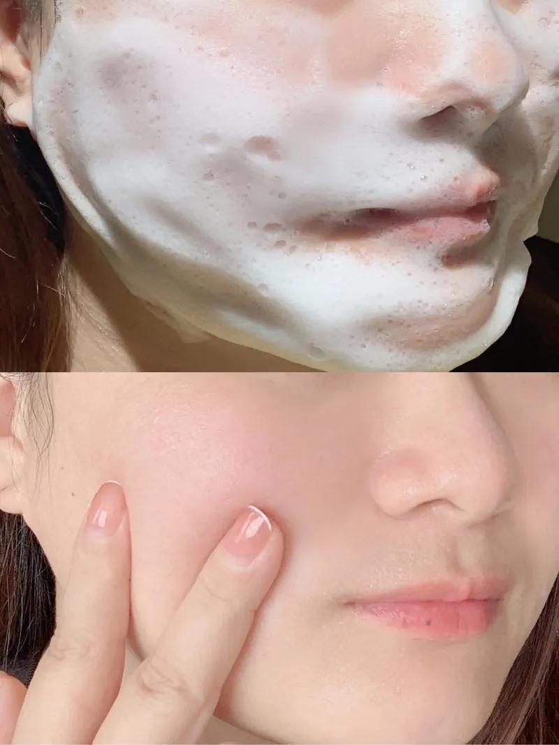 美白最有效的方法_皮膚暗沉原因_科學(xué)美白方法